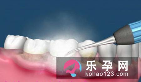 胎儿的性别鉴定可以靠技术吗