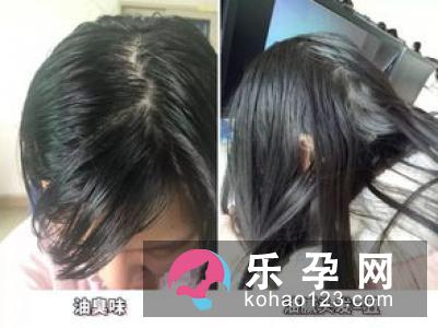 孕妇头发油啥原因 头发长会跟孩子抢营养吗