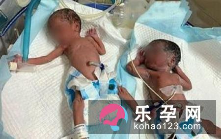丈夫进产房、剪脐带未来会成为时尚