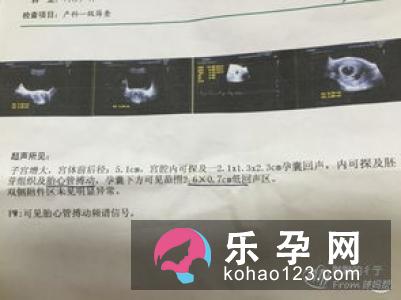 孕囊有积液怎么办 有回声和无回声是什么意思