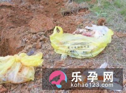 十个月的宝宝可以吃黄鳝吗 可以吃鸡肝吗