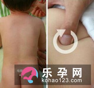 骨盆大小影响分娩难易程度