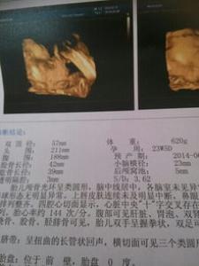 通过孕囊数据看生男生女大解析