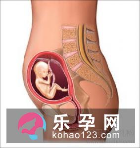 胎盘低置可以引产吗 都生的男孩吗