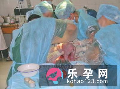 分娩时孕妇和胎儿在做什么