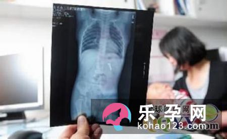 宝宝哭闹缺什么 呕吐怎么回事 宝宝哭闹缺什么 呕吐怎么回事