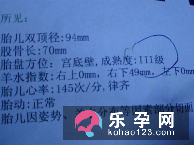 羊水指数四个值怎么看 有一个0怎么办