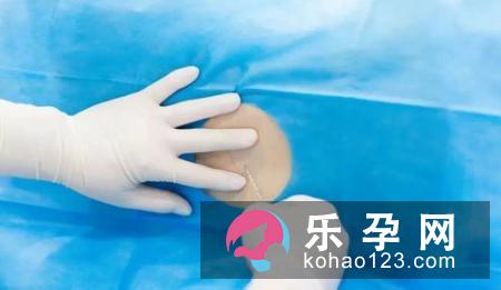 分娩的疼痛因人而异