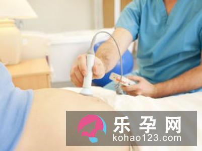 五个方法可以让分娩更顺利