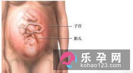 合理锻炼让分娩变得不再可怕