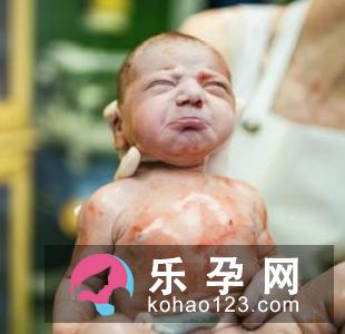 产中使用催产素会不会影响到胎儿