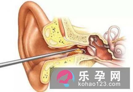 宝宝耳屎多正常的吗 影响听力吗 宝宝耳屎多正常的吗 影响听力吗