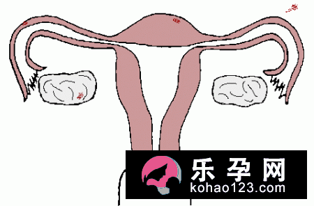 可以提高生女孩的几率