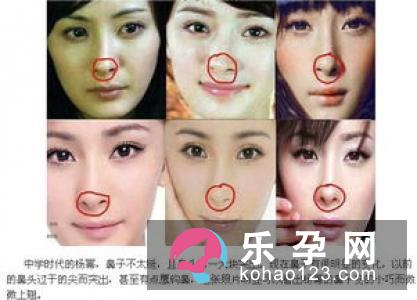 专家对民间判断胎儿男女方法的反驳 专家对民间判断胎儿男女方法的反驳