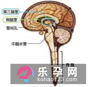 侧脑室增宽是什么意思 诊断标准是怎样的
