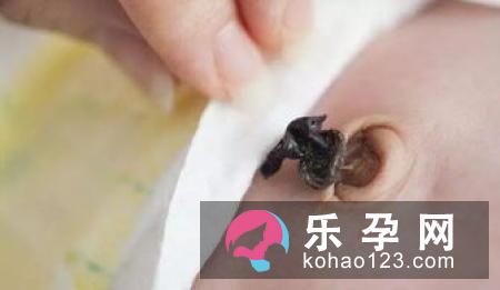 晚剪脐带对于宝宝的健康有好处
