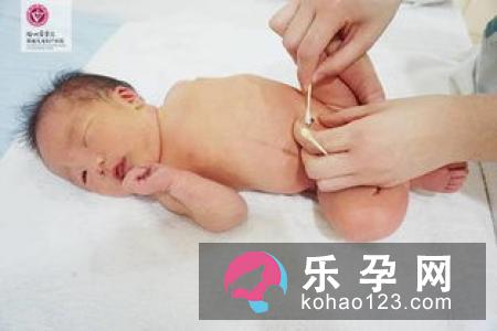 晚剪脐带对于宝宝的健康有好处