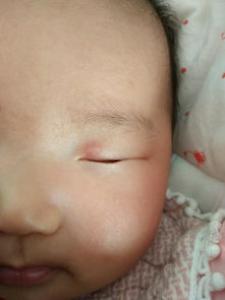 宝宝眼睛进东西怎么办妙招 有红血丝怎么回事