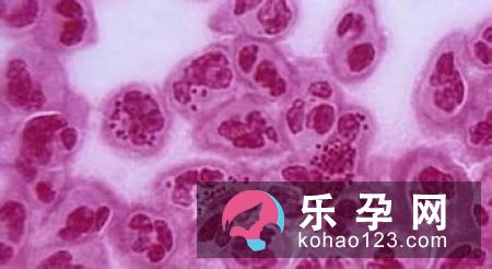 女性宫颈黏液黏度高容易生男孩