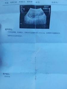怀孕7周是几个月 头晕怎么回事
