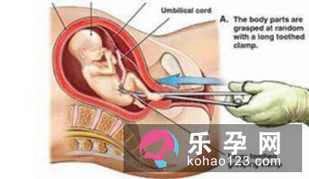 孕妇梦见莲藕是什么意思 是生男生女