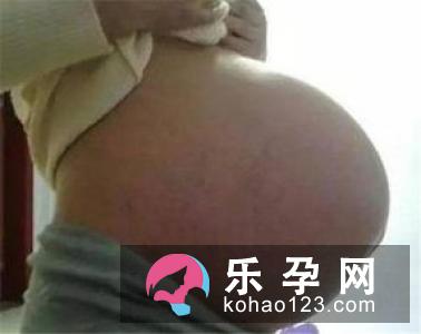 通过孕妇的状态 辨别胎儿的性别