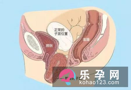 缓和产痛的分娩姿势有哪些