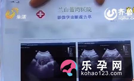 辨别胎儿性别只需掌握6大法宝