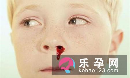 怀男孩鼻子会变大吗 孕妇流鼻血与胎儿性别有关吗