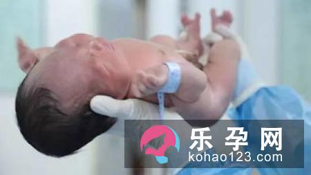 什么情况下需要做会阴侧切？