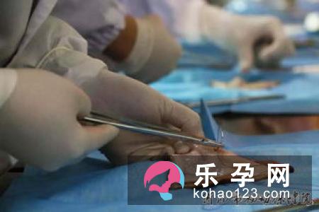 积极锻炼可避免进行会阴侧切